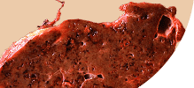 liver.png